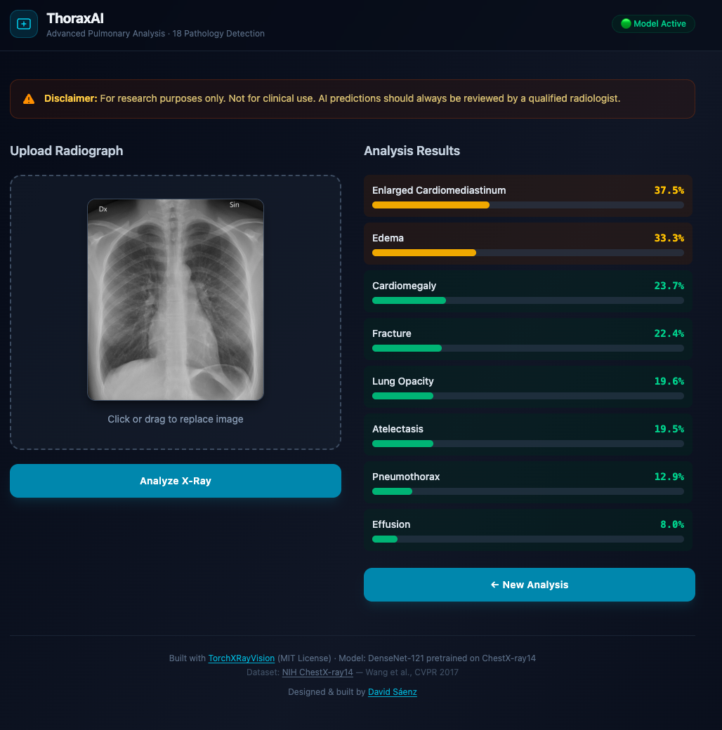 ThoraxAI - AI Pulmonary Analysis
